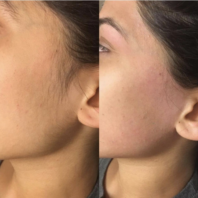 Wiki Hair Blocker Cream Smooth & Hair-Free Skin Solution